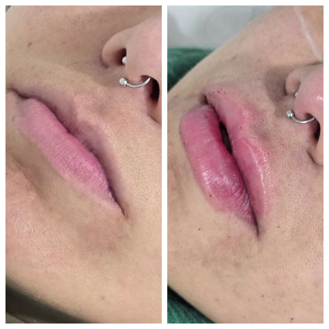 Sala de tratamento facial preparada para sessão